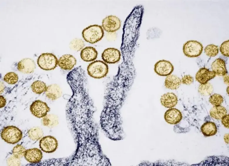 Tres personas murieron tras un presunto brote de hantavirus en un crucero. FOTO: Getty
