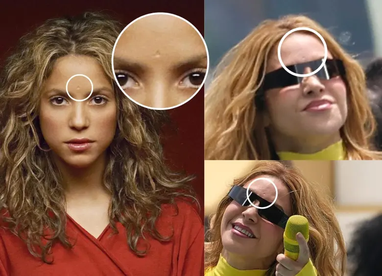 La cicatriz en la frente acompaña a Shakira desde 2003 y también es visible en imágenes de la inauguración del Mundial 2026. Foto: tomadas de redes sociales / montaje EL COLOMBIANO
