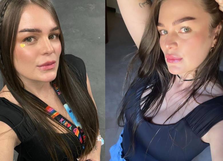 La hermana mayor de Karol G, Verónica Giraldo, sufrió un accidente de auto en octubre pasado y los últimos meses han sido de recuperación. FOTO: REDES SOCIALES @VEROGIRALDONAVARRO