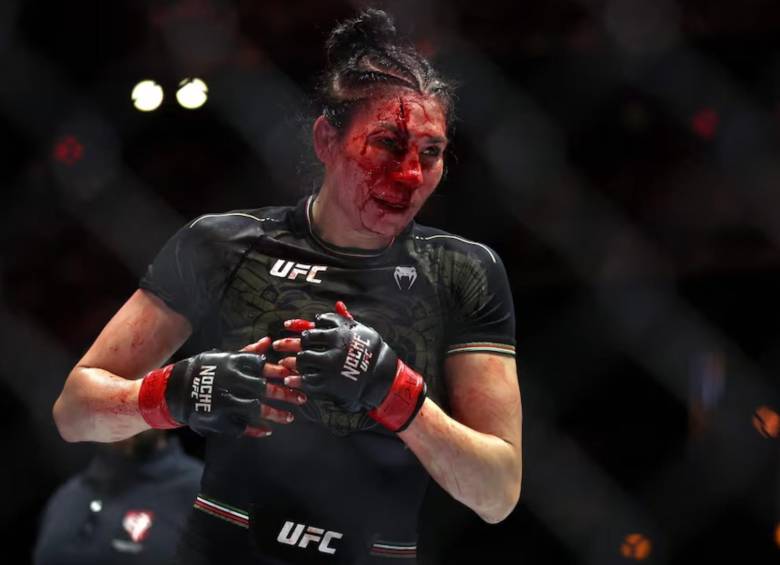 Así termino la luchadora mexicana Irene Aldana tras caer derrotada ante la brasileña Norma Dumont durante su pelea en Las Vegas. FOTO: AFP