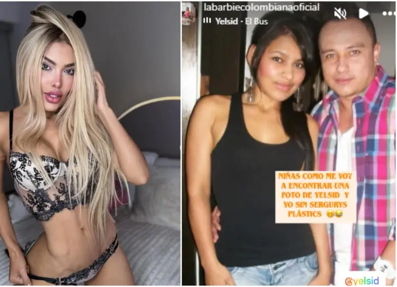 La Barbie Colombiana subió fotos a sus historias de Instagram de como se veía antes de las operaciones. FOTO: Tomada de redes sociales @labarbiecolombianaoficial