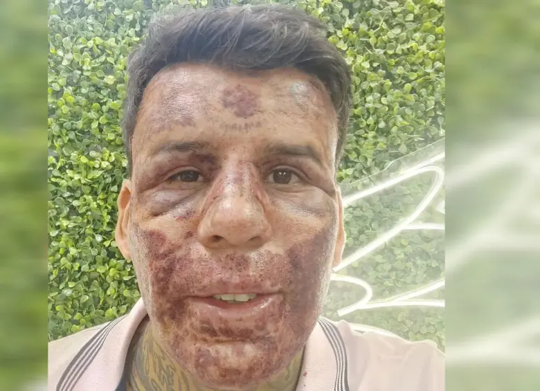Así ha lucido Leandro mostrando su transformación. Foto: @leandrodesouzabless