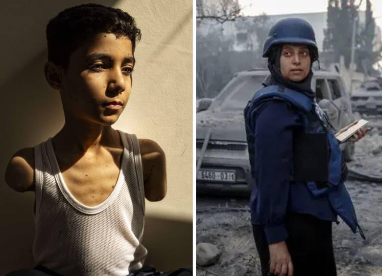 Samar Abu Elouf fue la ganadora del World Press Photo 2025 por la imagen del pequeño Mahmoud Ajjour. FOTOS: World Press Photo -Samar Abu Elouf