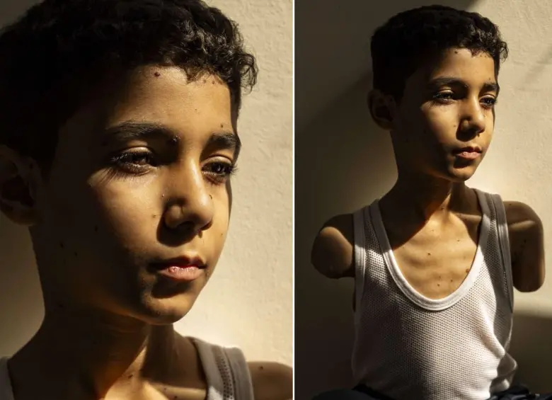 Esta es la fotografía de Mahmoud Ajjour que ganó el World Press Photo este 2025. FOTO: World Press Photo -Samar Abu Elouf 