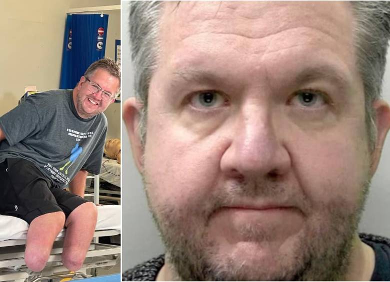 Neil Hopper es un hombre de Reino Unido que fue condenado por engañar a las aseguradoras de su país. FOTOS: Policía de Devon y Cornwall - tomada de Instagram - @bionicsurgeon