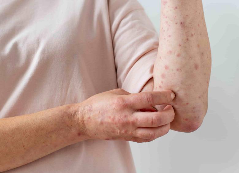 La medida se da luego de que cuatro casos sospechosos, todos con antecedente de viaje internacional, entraran en estudio en el país. FOTO: FREEPIK.