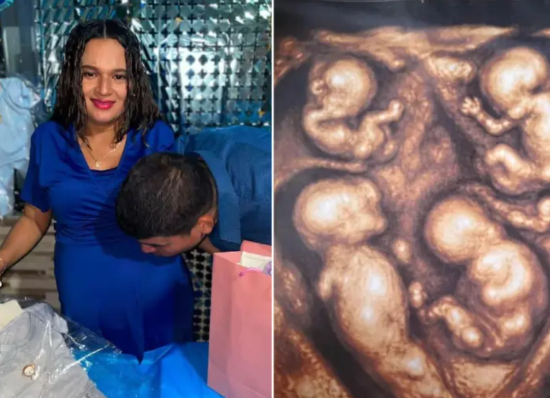 María Tapia y Jonatan Zapa esperan cuatrillizos idénticos. Foto: tomada de TikTok @cuatrillizoscaucasia