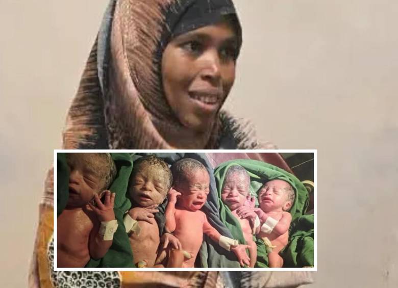 Después de 12 años de “larga espera” y de enfrentar el juicio social de su comunidad, Bedriya Adem ha transformado su realidad en la región de Harari, Etiopía. FOTO: Hospital Especializado Hiwot Fana