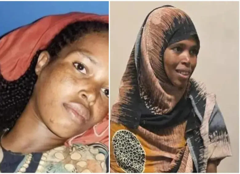 Bedriya Adem, la mujer que a sus 35 años tuvo cinco hijos. FOTO: Hospital Especializado Hiwot Fana