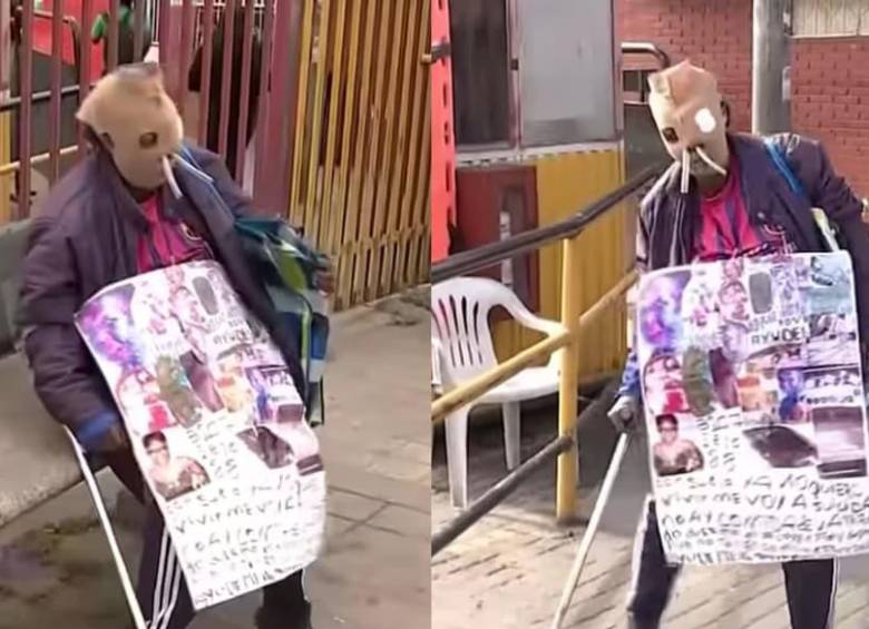 María Consuelo Córdoba ha enfrentado durante 26 años las secuelas físicas del ataque con ácido que sufrió en Bogotá. FOTO: Captura de pantalla Citytv.