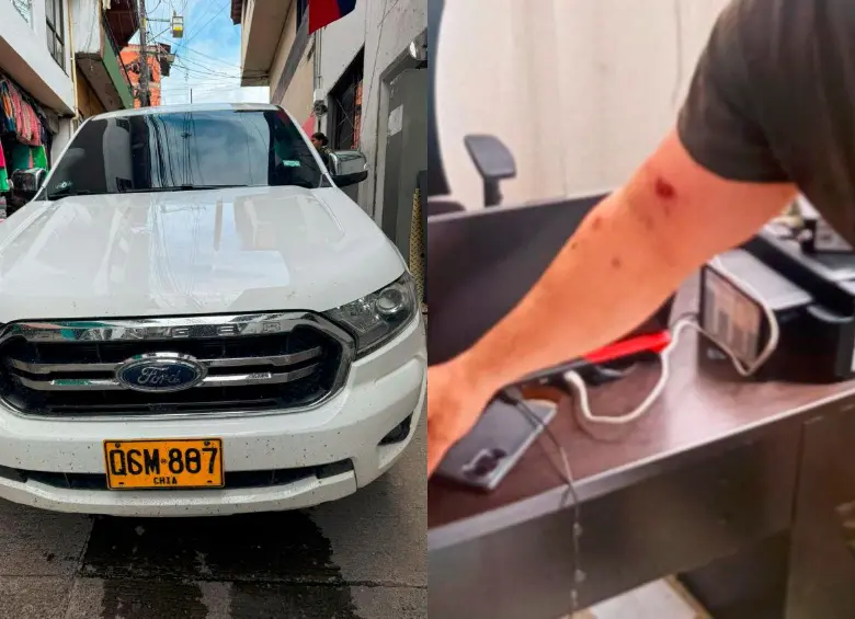 En la camioneta (izq.) se movilizaba el comandante operativo de la Policía Antioquia, coronel Gerson Bedoya Piraquive, junto con tres uniformados por Cañasgordas cuando fueron víctimas de un ataque por parte del Clan del Golfo. El alto oficia sufrió una herida en su brazo (der.). FOTOS: CORTESÍA