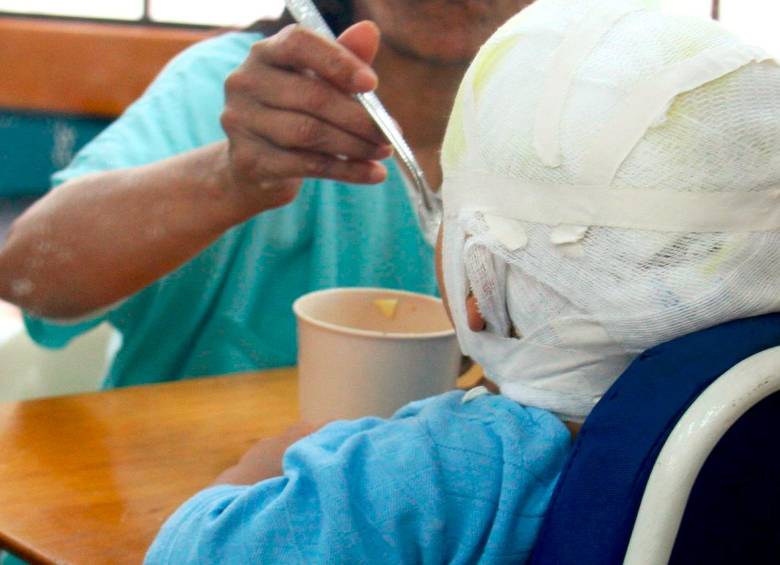 El menor fue atendido durante varios días en el Hospital San Vicente Fundación, de Medellín, donde falleció por la gravedad de las quemaduras. FOTO: ARCHIVO