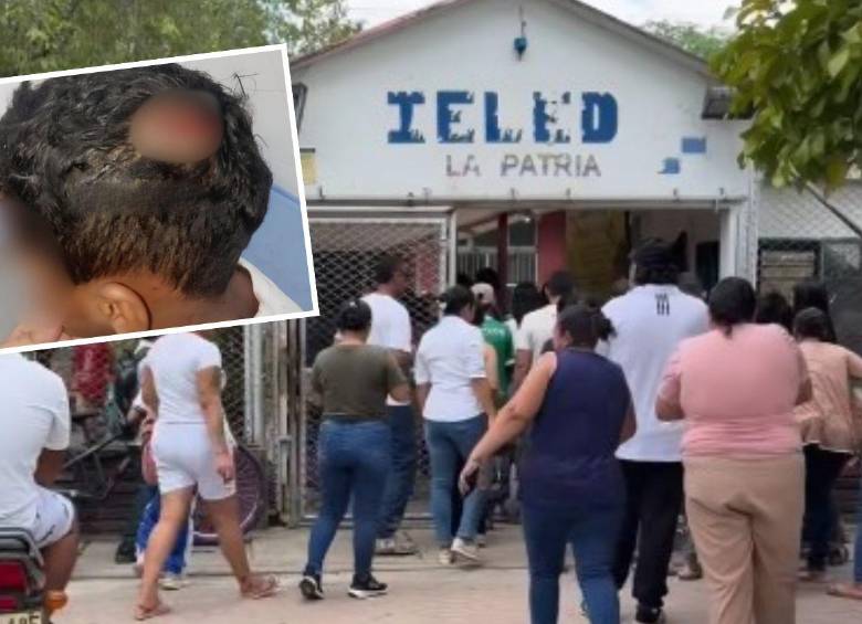 Los hechos ocurrieron en la Institución Educativa Luis Eduardo Díaz, sede La Patria. Los menores sufrieron lesiones en la cabeza y algunas extremidades, pero luego de la valoración médica se estableció que estas no revistieron gravedad. FOTO: CORTESÍA