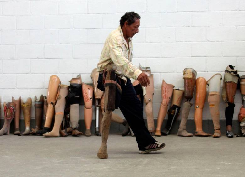 El ITM busca conocer las condiciones en las que una prótesis de pierna queda adecuada a las personas. FOTO: ARCHIVO