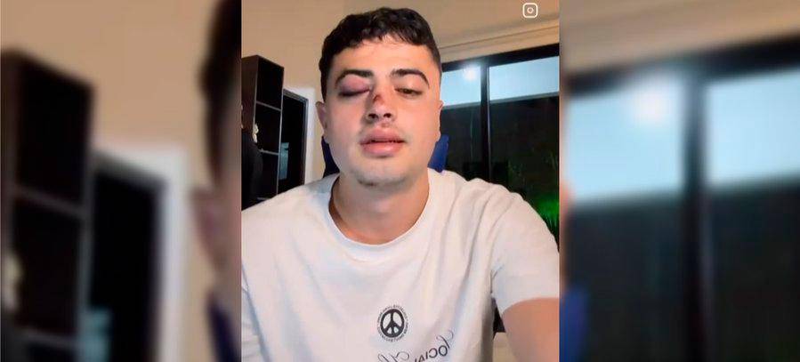 El joven contó el hecho en su cuenta de Instagram y pidió ayuda para acceder a las cámaras que permitan identificar al agresor. IMAGEN TOMADA DE INSTAGRAM