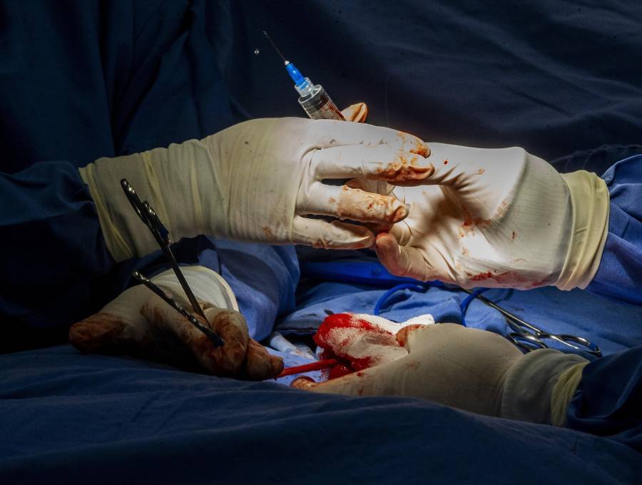 Imagen de referencia de una cirugía de transplante de órganos. FOTO: JULIO CÉSAR ECHEVERRI