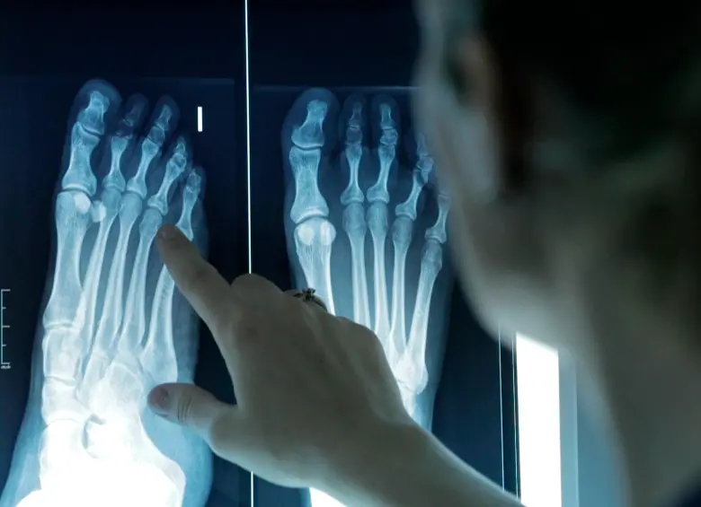 Imagen de una profesional sanitaria examinando una radiografía. FOTO: Europa Press / ICOPCV