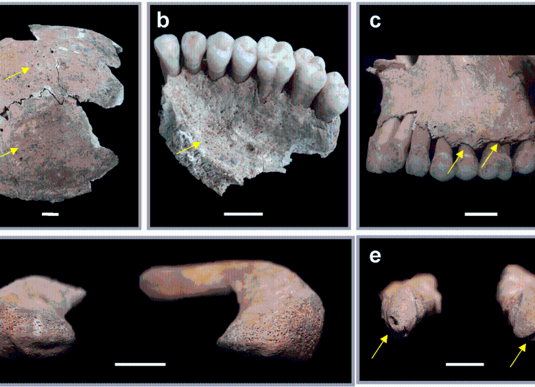 Imagen de la dentadura de estos hermanos. FOTO: Cortesía Agencia Sinc