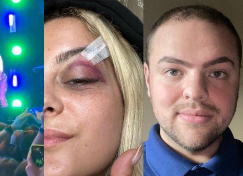 La cantante estadounidense fue golpeada por un celular en concierto. FOTO: Twitter @DailyLoud, Instagram @beberexha y LinkedIn @Nick Malvagna