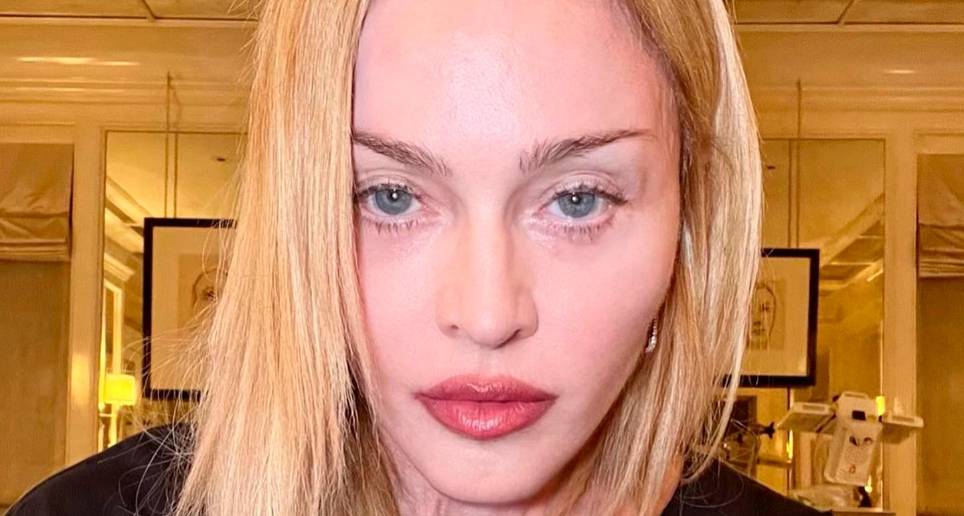 Esta fue la selfie que compartió la reina de pop en el post que habla de su recuperación. FOTO IG Madonna