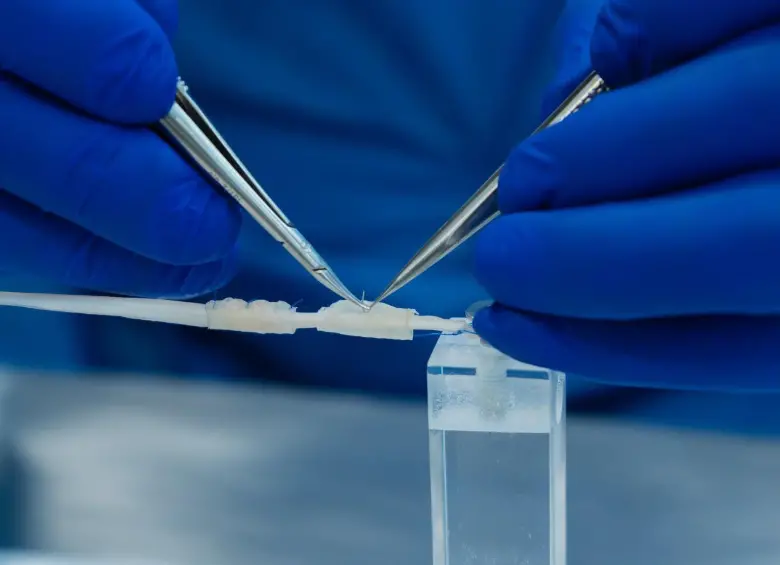 El neurotubo bioabsorbible busca reemplazar los injertos en lesiones de nervios periféricos. FOTO cortesía Ruta n