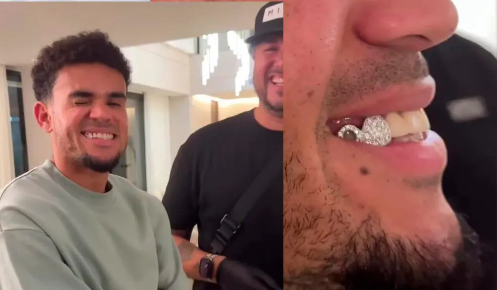 Los <i>grillz</i> están hechos de oro o plata, y pueden tener incrustraciones de piedras preciosas. FOTO Tomada de Instagram