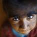 Reuters - El hijo menor de Devi a&#250;n no puede practicarse este tratamiento debido a su corta edad.