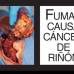 Foto Cortesía - El Ministerio de Salud y Protección Social publicó las imágenes de advertencia sanitarias para las cajetillas de cigarrillo 2013 - 2014, de acuerdo a la resolución 3961 del 2009, por la cual se establecen los requisitos de empaquetado y etiquetado del tabaco y sus derivados.