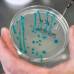 Reuters - Los cient&#237;ficos alemanes fueron burlados por una cepa de la bacteria Escherichia coli enterohemorr&#225;gica, durante varios d&#237;as buscaron, sin resultados, el origen de la bacteria que ha dejado m&#225;s de 30 muertos en Alemania.