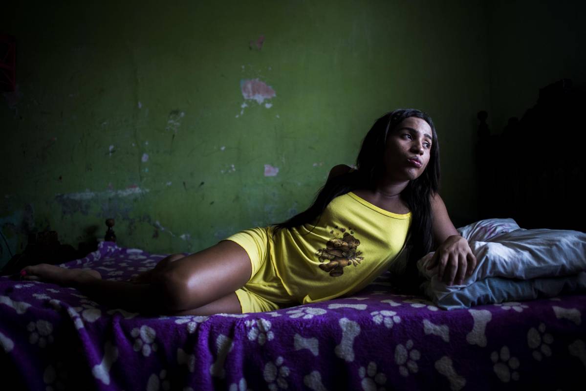 Melissa Puello se recupera de una herida en la pierna derecha. Un hombre la golpeó y la apuñaló en Ciénaga, municipio del Magdalena. Aún no entiende por qué intentaron matarla. Foto: Charlie Cordero 