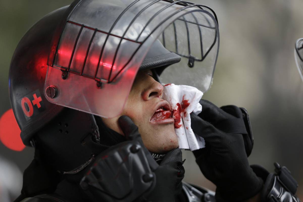 Estos hechos fueron los que permitieron que las autoridades impusieran 95 comparendos a quienes han participado en los bloqueos e inmovilizaran 13 carros. FOTO AP