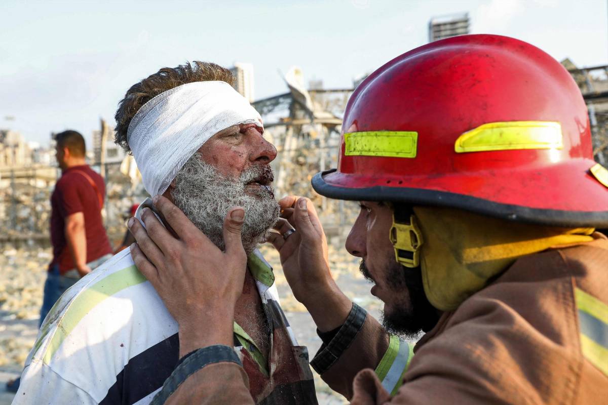 Un bombero controla a un hombre herido cerca de la escena de una explosión en Beirut. El ministro de Sanidad, Hamad Hasan, anunció que hay “muchos heridos y cuantiosos daños materiales”. Foto: AFP