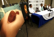 AP Los doctores Michelle Hasni (izq.), Salih Yasin (centro) y Peter L. Ferrer (der.) ofrecieron una conferencia de prensa en la que aclararon la situación actual del bebé y explicaron las cirugías que se le practicarán a largo plazo.