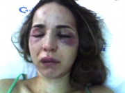 De la imagen feliz de una fiesta a una mujer maltratada