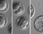 SEcuencia que muestra el desarrollo de embriones luego de la co-inyección de una enzima correctora del gen y espermatozoides de un donante con la mutación. Foto cortesía OHSU