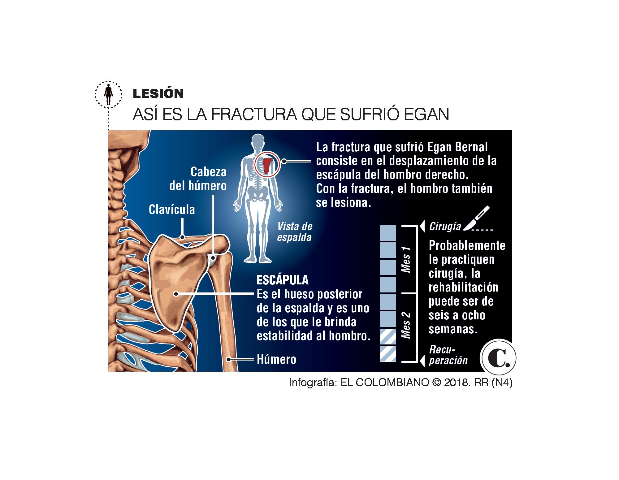 InfogrÃ¡fico