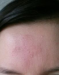 Afectados tras imposición de la Santa Ceniza en Rionegro serían más de 50