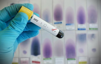 La ONU insta a promover la prueba para detectar el HIV (siglas en inglés, en español VIH). FOTO SSTOCK