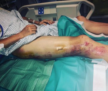 Un año del escalofriante accidente de Froome antes del Tour