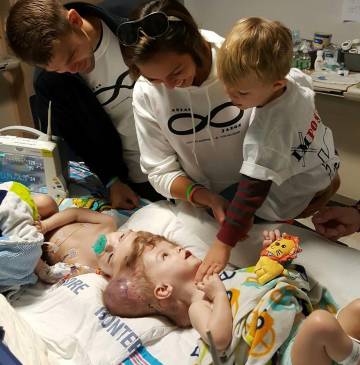 La operación para separar a Jadon y Anias duró 16 horas. FOTO Cortesía Facebook Nicole McDonald