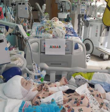 Esta fue la imagen que compartió la madre después de la cirugía. Ambos niños están estables. FOTO Cortesía Facebook Nicole McDonald