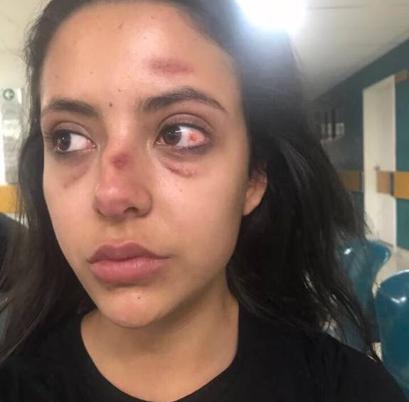 Modelo denuncia que fue golpeada por su suegra en Medellín
