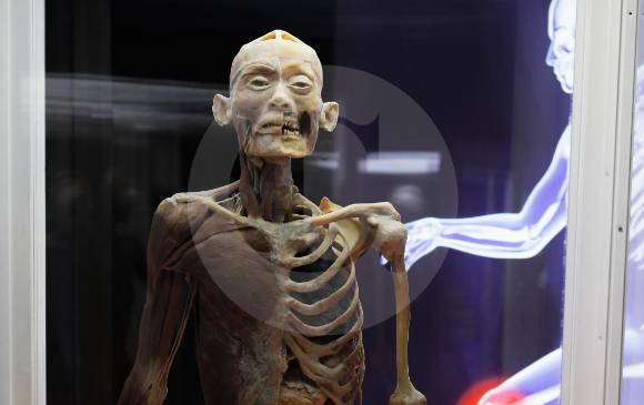 Poder observar el interior del cuerpo humano 
