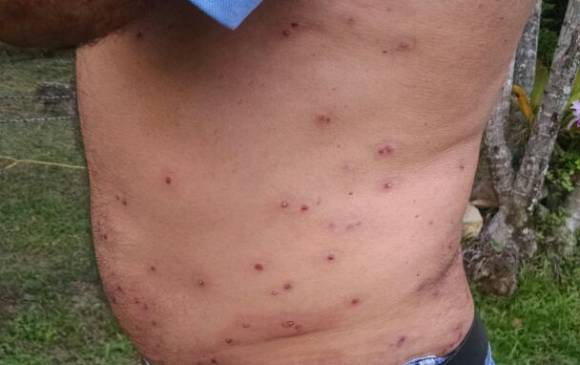 Dos bomberos y el dueño de la finca fueron picados por las abejas.