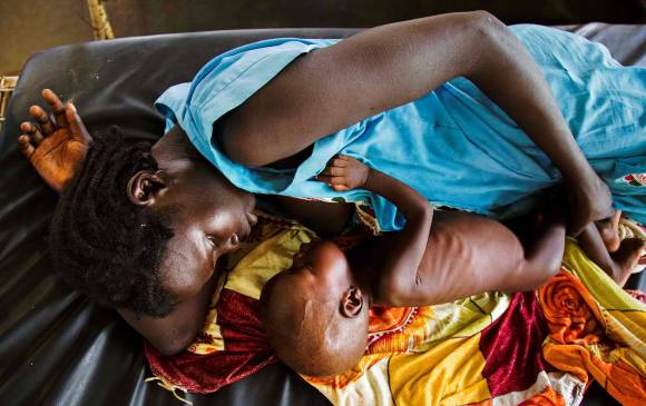 Millones de personas sufren a diario por desnutrición en el mundo y la reacción de la comunidad internacional es insuficiente. FOTO afp