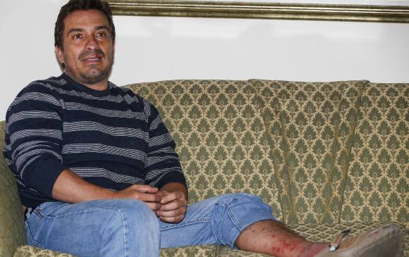 Jorge Iván Morales sobrevivió junto con Hernán Darío Rodriguez a un naufragio. Mientras se recupera de las heridas, accedió a contar su historia. FOTO JULIO CÉSAR HERRERA