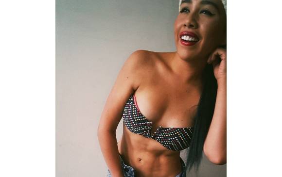 Yina Calderón volverá al quirófano