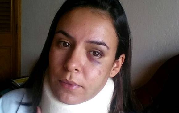Medicina Legal incapacitó por 25 días a la modelo Adriana Cardona, que dice haber sido golpeada por su novio. FOTO Cortesía