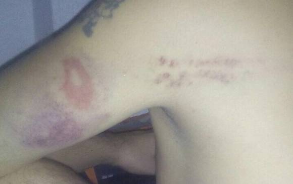 Así terminó el detenido luego de la agresión en la estación de Policía de Laureles. FOTO CORTESÍA
