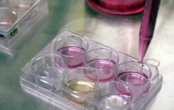 Los avances en medicina genética también han permitido llegar a nuevos estadios del tratamiento contra el cáncer. FOTO archivo